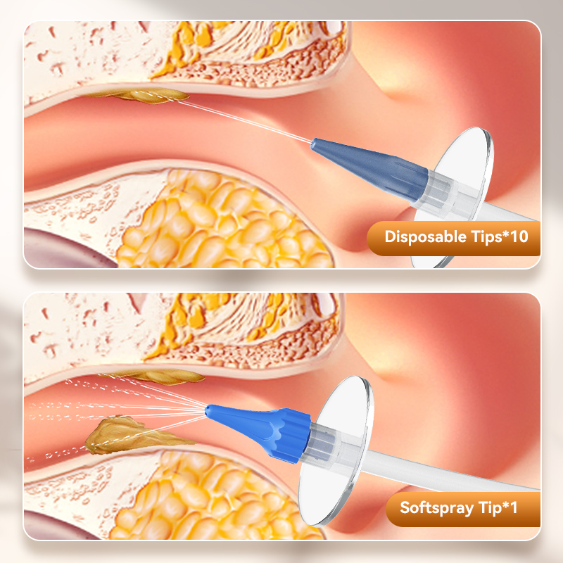 Ear Wax Removal Manual Ear Irr - đánh giá và giá Urban Farming System